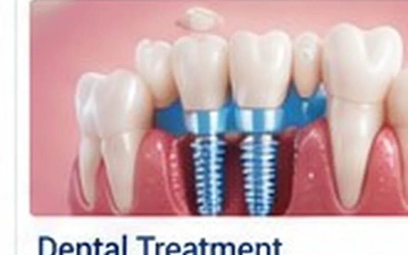 Dental Treatment