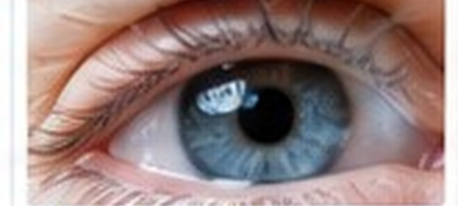 Cataract Surgery Per Eye medical care in India