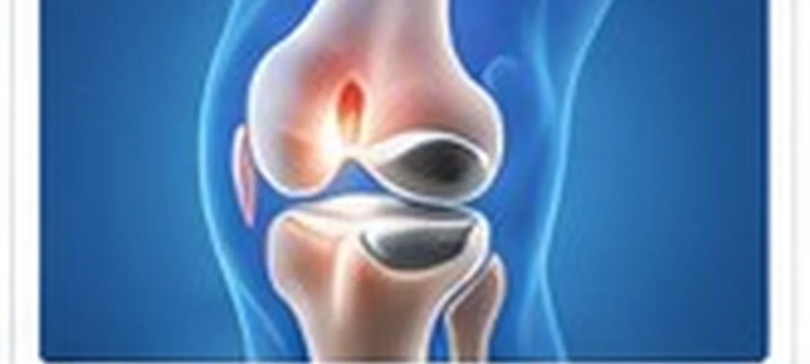 Total Knee Replacement Single medical care in India