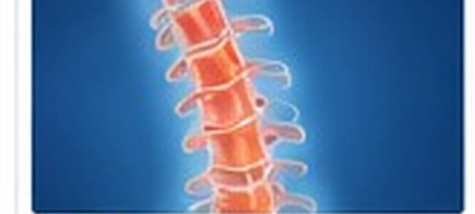 Artificial Disc Replacement medical care in India